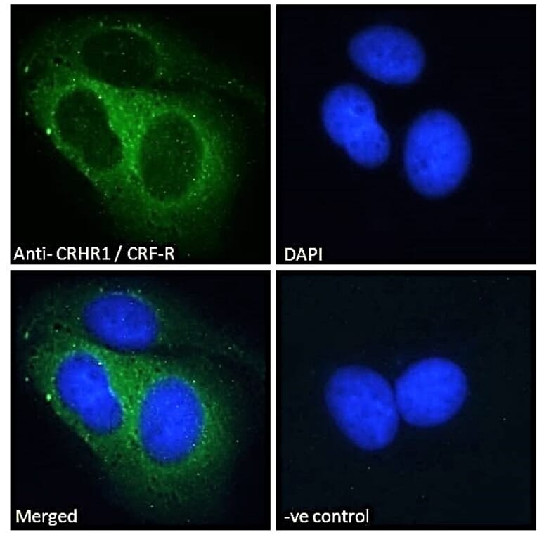 Immunofluorescence - Anti-CRF1/CRHR1 Antibody (A84278) - Antibodies.com