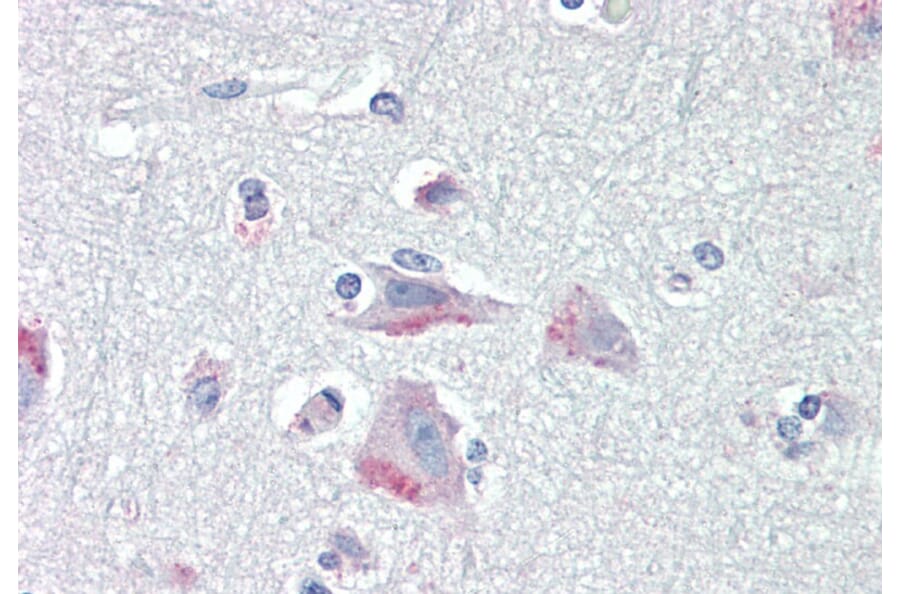 Immunohistochemistry - Anti-CRF1/CRHR1 Antibody (A84278) - Antibodies.com