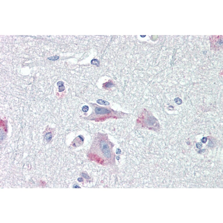 Immunohistochemistry - Anti-CRF1/CRHR1 Antibody (A84278) - Antibodies.com