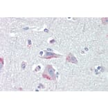Immunohistochemistry - Anti-CRF1/CRHR1 Antibody (A84278) - Antibodies.com