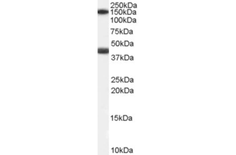 Western Blot - Anti-GALR1 Antibody (A84280) - Antibodies.com