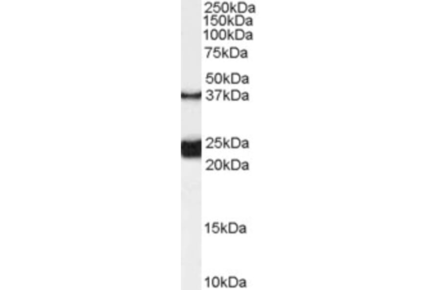 Western Blot - Anti-GALR1 Antibody (A84281) - Antibodies.com