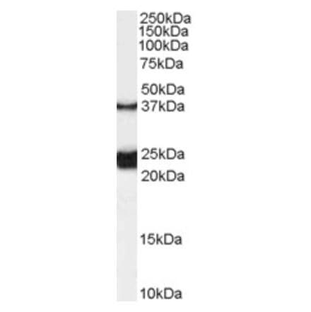 Western Blot - Anti-GALR1 Antibody (A84281) - Antibodies.com