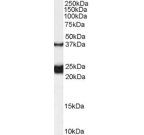 Western Blot - Anti-GALR1 Antibody (A84281) - Antibodies.com