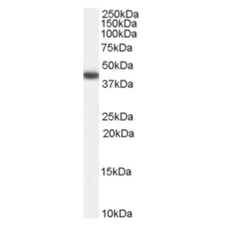 Western Blot - Anti-GALR2 Antibody (A84282) - Antibodies.com