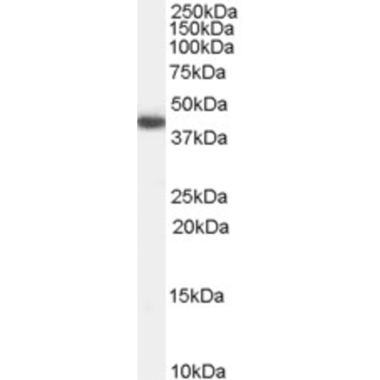 Western Blot - Anti-GALR2 Antibody (A84282) - Antibodies.com