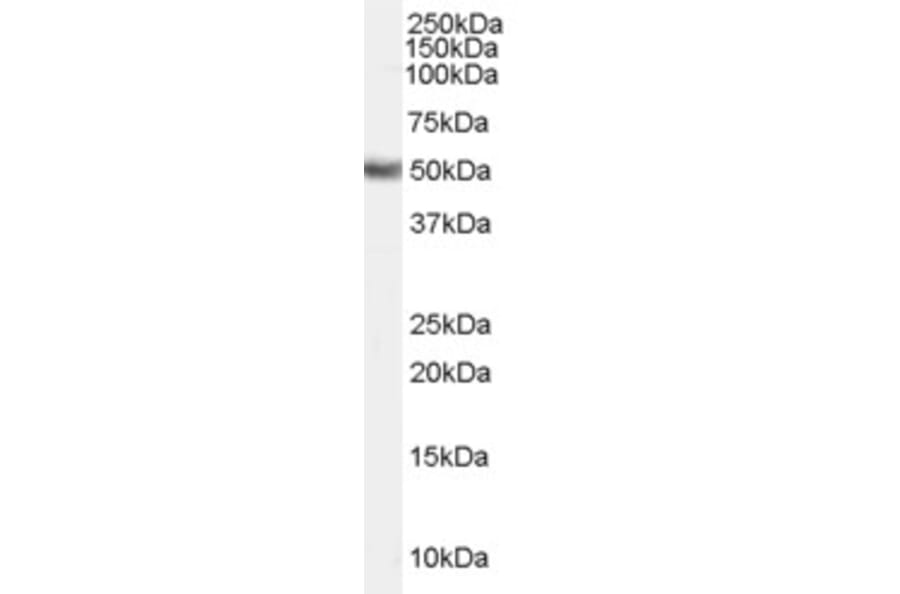 Western Blot - Anti-FADS1 Antibody (A84283) - Antibodies.com