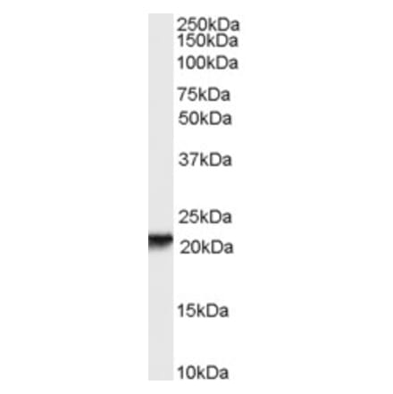 Western Blot - Anti-RBP4 Antibody (A84284) - Antibodies.com