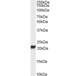 Western Blot - Anti-RBP4 Antibody (A84284) - Antibodies.com