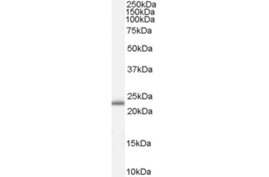 Western Blot - Anti-RBP4 Antibody (A84285) - Antibodies.com