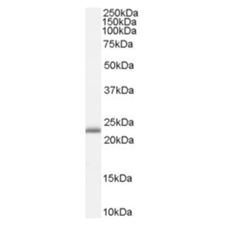 Western Blot - Anti-RBP4 Antibody (A84285) - Antibodies.com