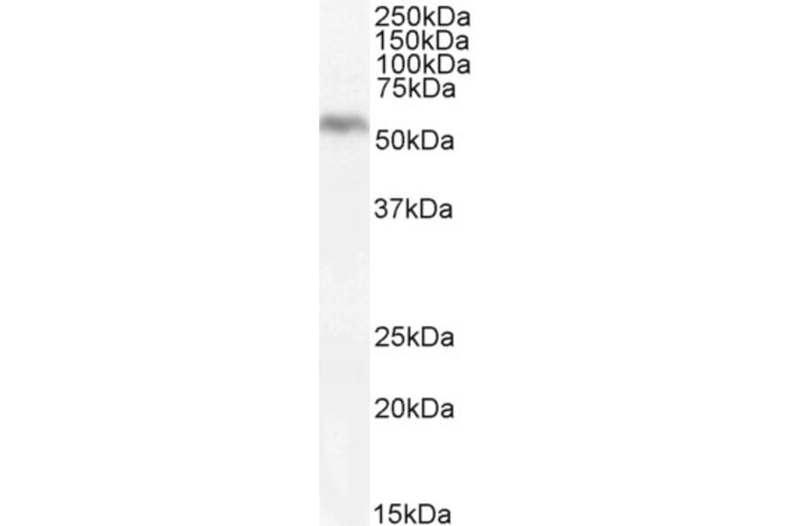 Western Blot - Anti-DGAT1 Antibody (A84286) - Antibodies.com
