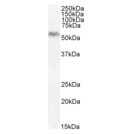 Western Blot - Anti-DGAT1 Antibody (A84286) - Antibodies.com