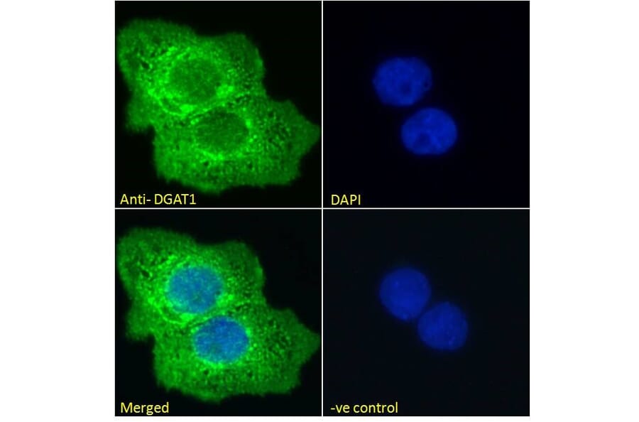 Immunofluorescence - Anti-DGAT1 Antibody (A84286) - Antibodies.com