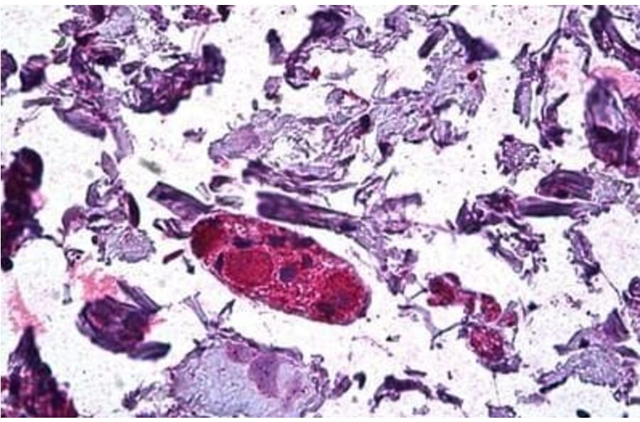 Immunohistochemistry - Anti-DGAT1 Antibody (A84286) - Antibodies.com