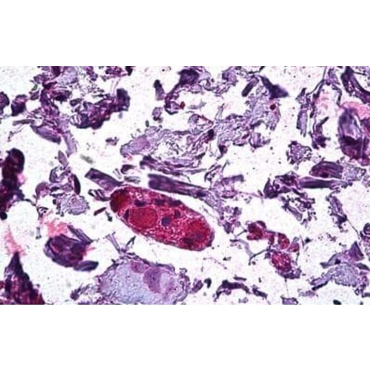 Immunohistochemistry - Anti-DGAT1 Antibody (A84286) - Antibodies.com