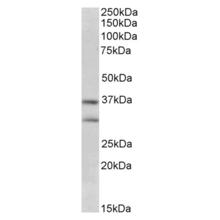 Western Blot - Anti-FGF 23 Antibody (A84288) - Antibodies.com