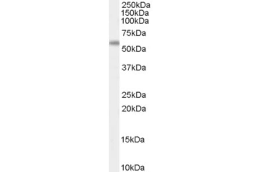 Western Blot - Anti-AIRE Antibody (A84291) - Antibodies.com