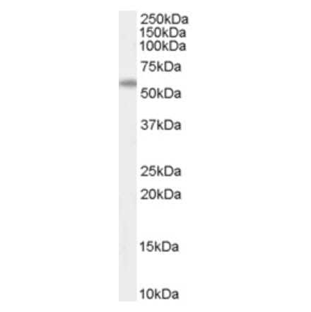 Western Blot - Anti-AIRE Antibody (A84291) - Antibodies.com