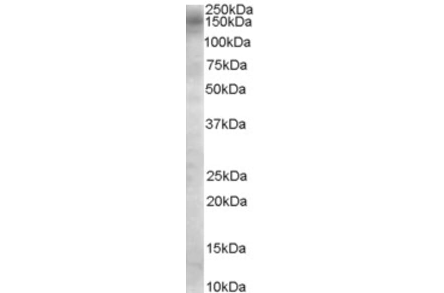 Western Blot - Anti-AS160 Antibody (A84293) - Antibodies.com