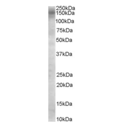 Western Blot - Anti-AS160 Antibody (A84293) - Antibodies.com