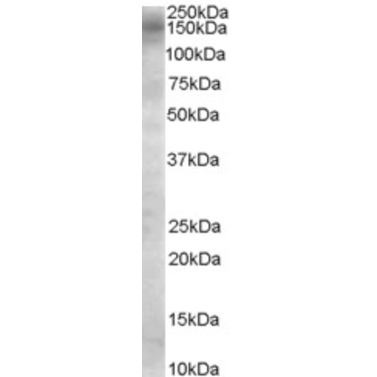 Western Blot - Anti-AS160 Antibody (A84293) - Antibodies.com