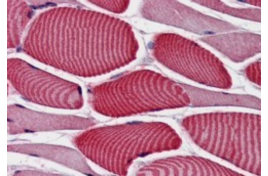 Immunohistochemistry - Anti-AS160 Antibody (A84293) - Antibodies.com