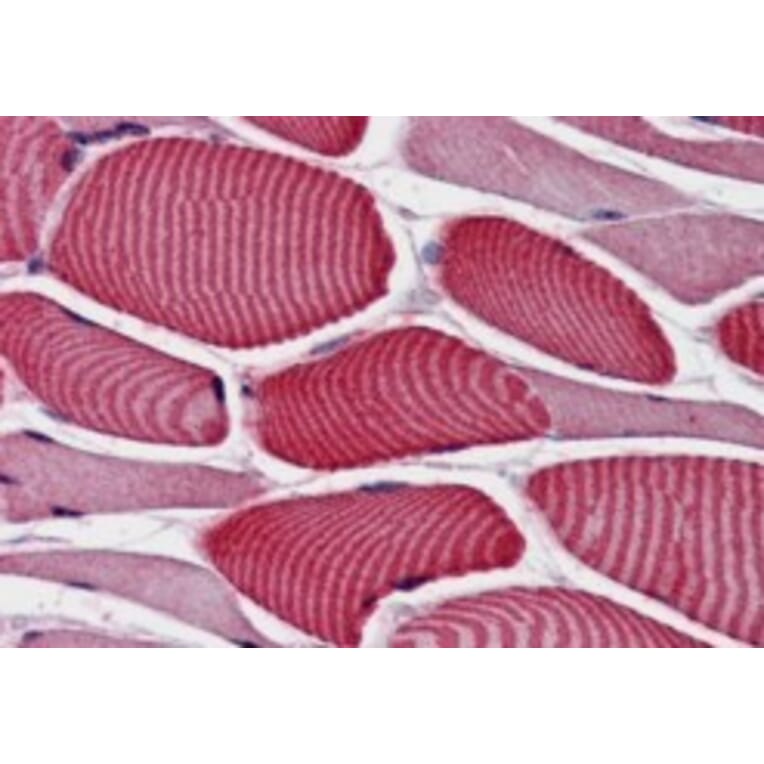 Immunohistochemistry - Anti-AS160 Antibody (A84293) - Antibodies.com