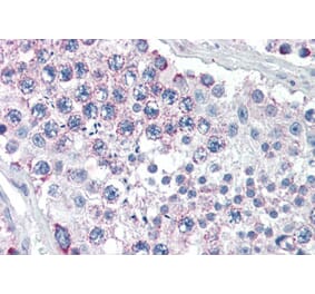 Immunohistochemistry - Anti-LGN Antibody (A84294) - Antibodies.com