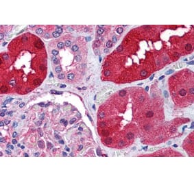 Immunohistochemistry - Anti-E3 Ubiquitin-Protein Ligase RNF213 Antibody (A84299) - Antibodies.com