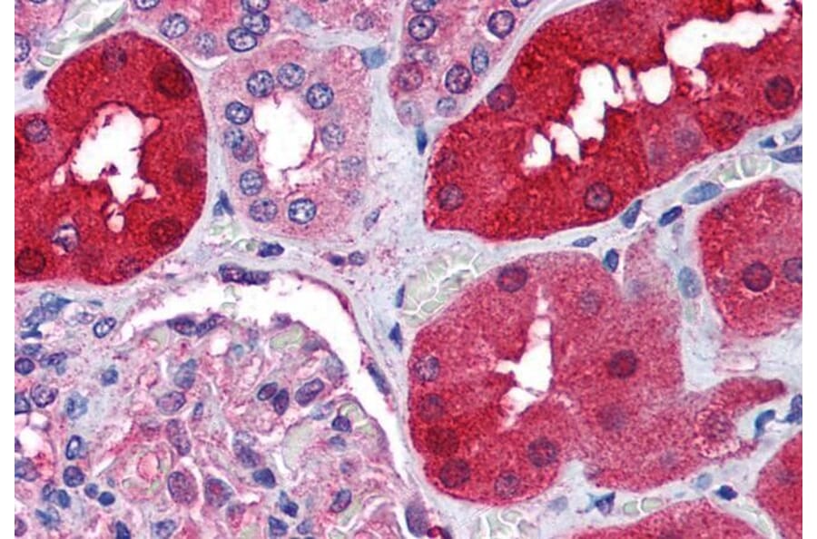 Immunohistochemistry - Anti-E3 Ubiquitin-Protein Ligase RNF213 Antibody (A84299) - Antibodies.com