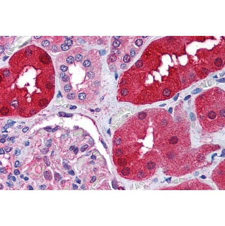 Immunohistochemistry - Anti-E3 Ubiquitin-Protein Ligase RNF213 Antibody (A84299) - Antibodies.com