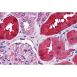 Immunohistochemistry - Anti-E3 Ubiquitin-Protein Ligase RNF213 Antibody (A84299) - Antibodies.com