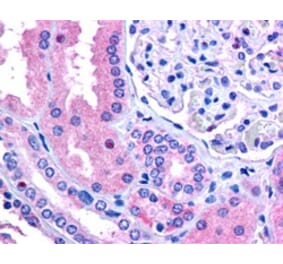Immunohistochemistry - Anti-E3 Ubiquitin-Protein Ligase RNF213 Antibody (A84300) - Antibodies.com