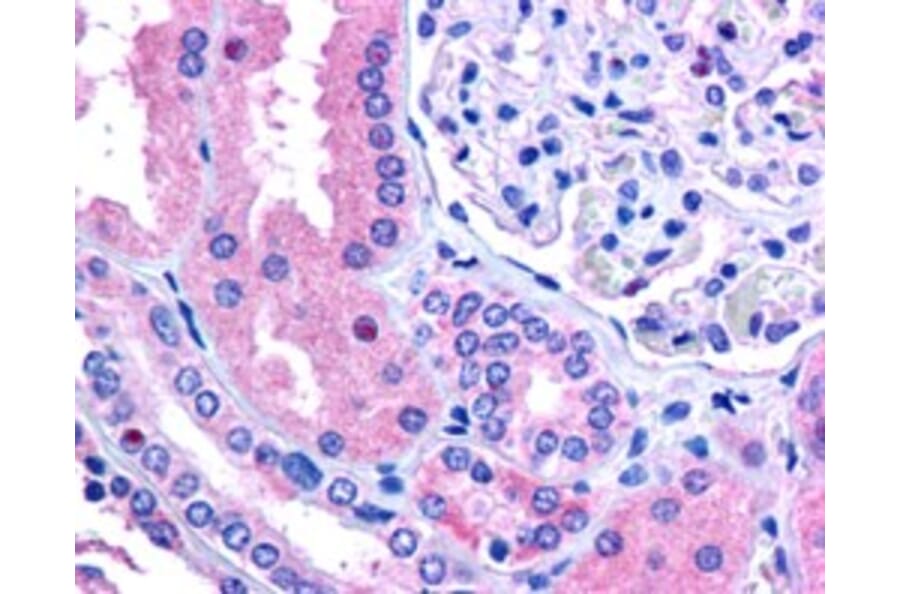 Immunohistochemistry - Anti-E3 Ubiquitin-Protein Ligase RNF213 Antibody (A84300) - Antibodies.com