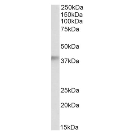 Western Blot - Anti-ADH5 Antibody (A84301) - Antibodies.com