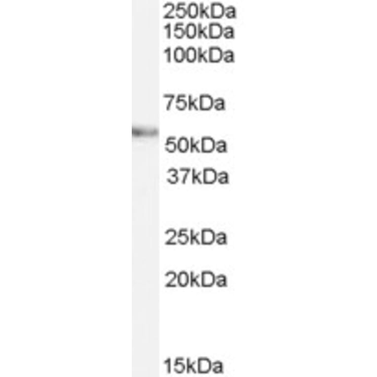Western Blot - Anti-VANGL2 Antibody (A84302) - Antibodies.com