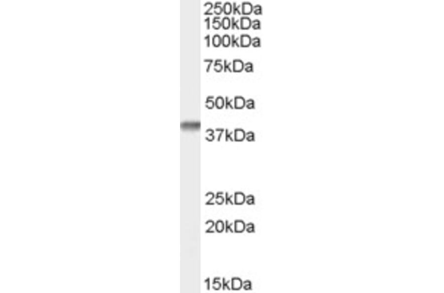 Western Blot - Anti-SFRP2 Antibody (A84304) - Antibodies.com