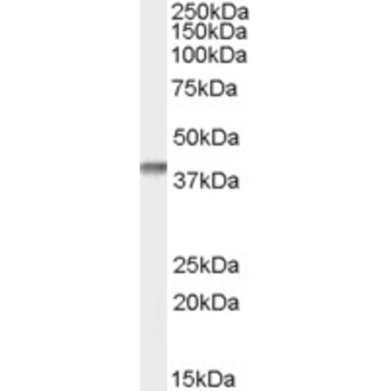Western Blot - Anti-SFRP2 Antibody (A84304) - Antibodies.com