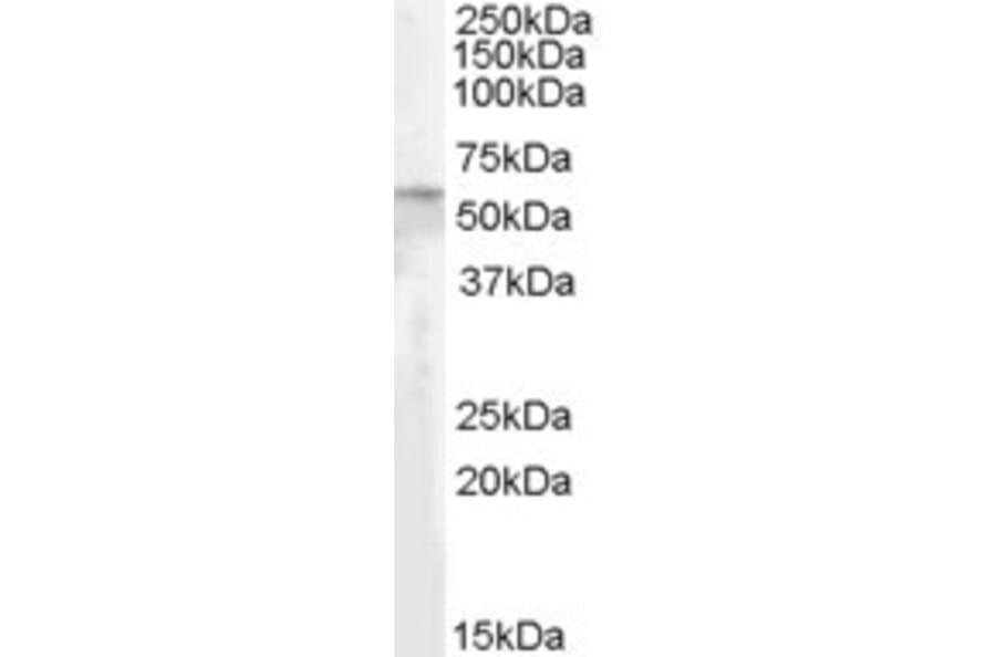 Western Blot - Anti-Adipose Triglyceride Lipase Antibody (A84306) - Antibodies.com