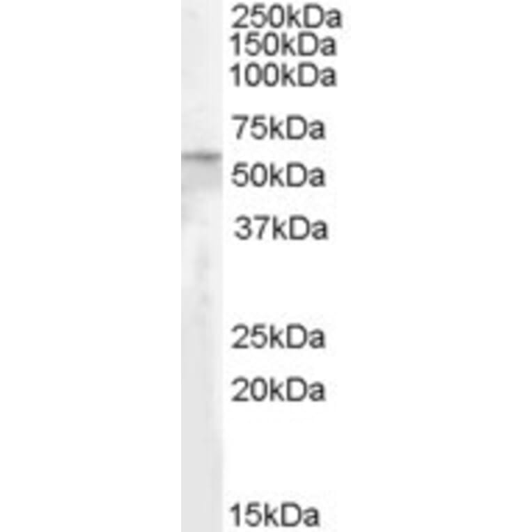 Western Blot - Anti-Adipose Triglyceride Lipase Antibody (A84306) - Antibodies.com