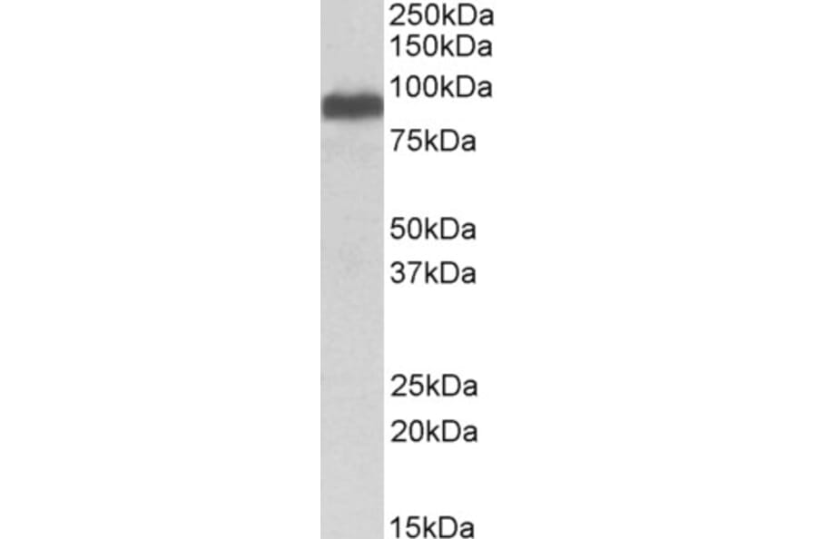 Western Blot - Anti-ITCH/AIP4 Antibody (A84307) - Antibodies.com
