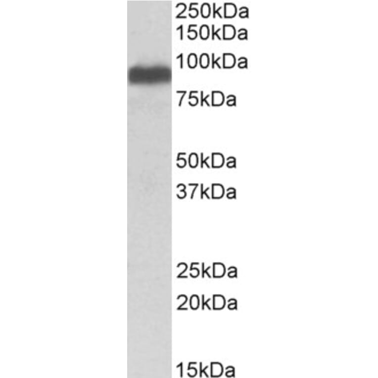 Western Blot - Anti-ITCH/AIP4 Antibody (A84307) - Antibodies.com