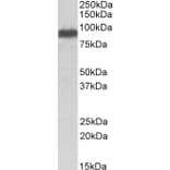 Western Blot - Anti-ITCH/AIP4 Antibody (A84307) - Antibodies.com