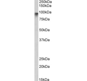 Western Blot - Anti-Neuroligin 2 Antibody (A84310) - Antibodies.com