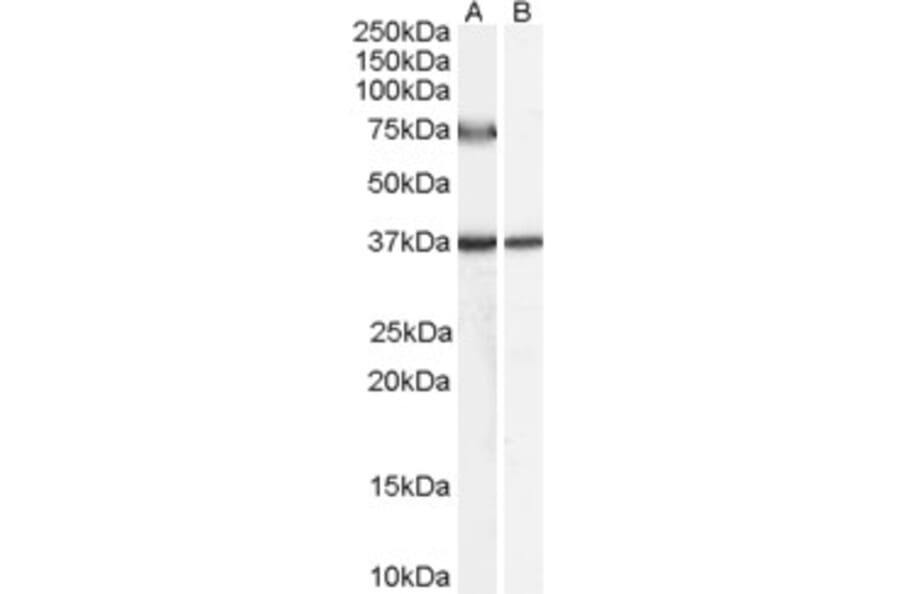 Western Blot - Anti-ACOX2 Antibody (A84311) - Antibodies.com