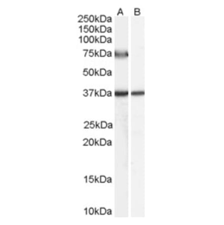 Western Blot - Anti-ACOX2 Antibody (A84311) - Antibodies.com