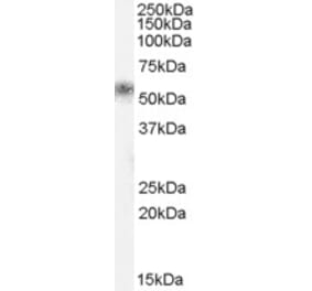 Western Blot - Anti-Tissue Kallikrein Antibody (A84312) - Antibodies.com