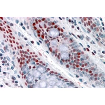 Immunohistochemistry - Anti-NAT10 Antibody (A84316) - Antibodies.com