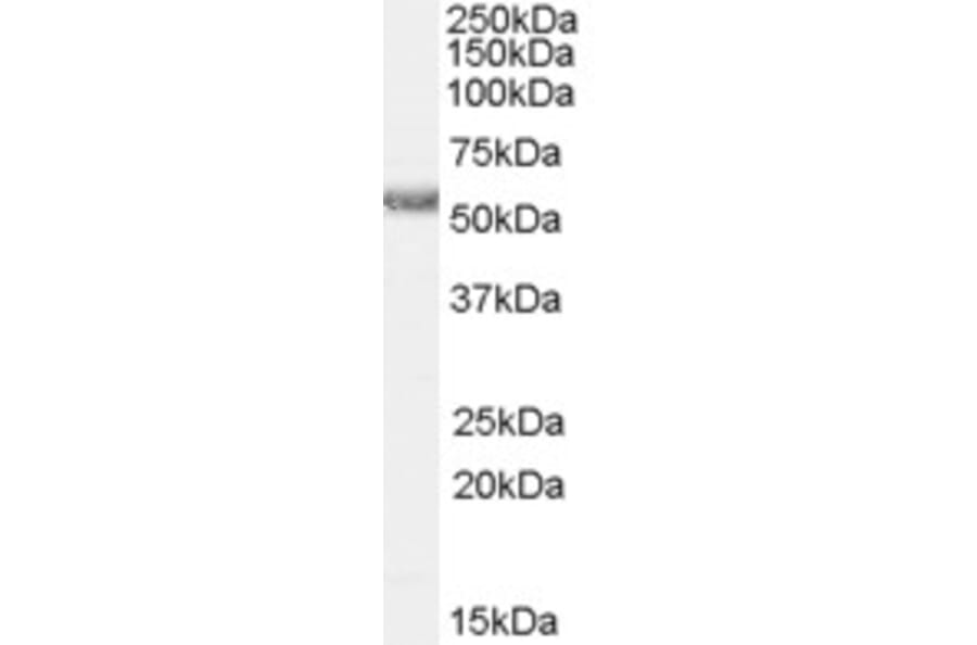 Western Blot - Anti-HRH1/H1R Antibody (A84317) - Antibodies.com